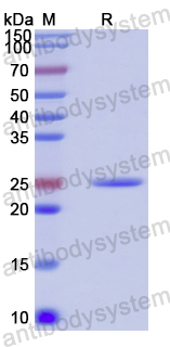 Recombinant Human TRIM15 Protein, N-His
