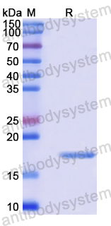 Recombinant Human MAP1LC3C Protein, N-His