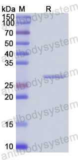 Recombinant Human EGLN1 Protein, N-His