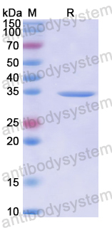 Recombinant Human TAOK1 Protein, N-His