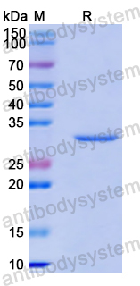 Recombinant Human VANGL2 Protein, N-His
