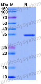 Recombinant Human MAGED1 Protein, N-His