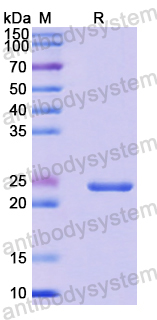 Recombinant Human NAP1L4 Protein, N-His