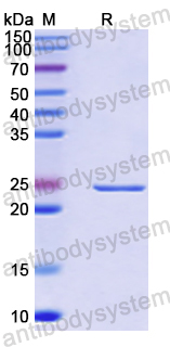Recombinant Human NDEL1 Protein, N-His