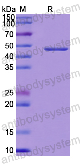 Recombinant Human ACAD9 Protein, N-His