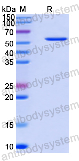 Recombinant Human ISYNA1 Protein, N-His