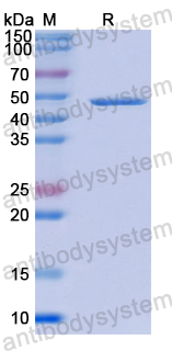 Recombinant Human NRCAM Protein, N-His