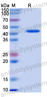 Recombinant Human NFS1 Protein, N-His