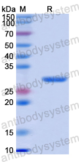 Recombinant Human EGLN3 Protein, N-His