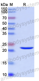 Recombinant Human PLAGL2 Protein, N-His