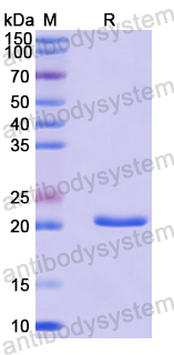 Recombinant Human PPP3R2 Protein, N-His