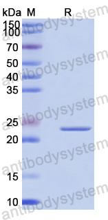Recombinant Human RAB17 Protein, N-His