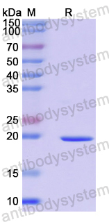 Recombinant Human CIAPIN1 Protein, N-His