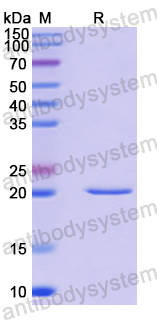 Recombinant Human COPS8 Protein, N-His