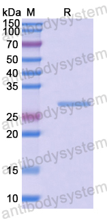 Recombinant Human DTX4 Protein, N-His