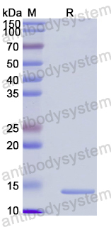 Recombinant Human EHBP1 Protein, N-His