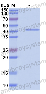 Recombinant Human EHD2 Protein, N-His