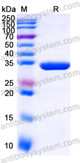 Recombinant Human EHMT2 Protein, N-His