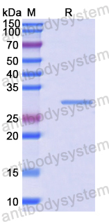 Recombinant Human EIF2AK1 Protein, N-His