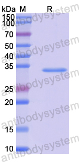 Recombinant Human NOX3 Protein, N-His