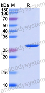 Recombinant Human NUP93 Protein, N-His