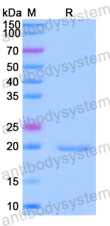 Recombinant Human RBCK1 Protein, N-His