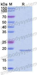 Recombinant Human RERG Protein, N-His