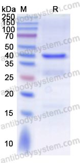 Recombinant Human RFWD3 Protein, N-His