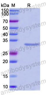Recombinant Human RLIM Protein, N-His