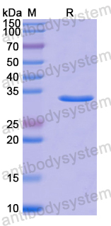 Recombinant Human SENP3 Protein, N-His