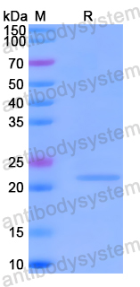 Recombinant Human SLC5A4 Protein, N-His-SUMO
