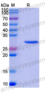 Recombinant Human SMARCC1 Protein, N-His