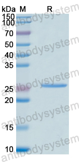 Recombinant Human SNX25 Protein, N-His