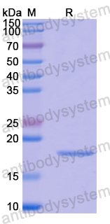 Recombinant Human SRPK1 Protein, N-His