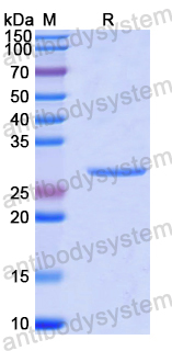 Recombinant Human SUFU Protein, N-His