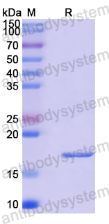 Recombinant Human SYCE1 Protein, N-His