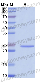 Recombinant Human STX12 Protein, N-His