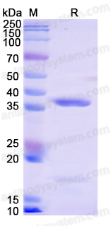 Recombinant Human SLC12A5/KCC2 Protein, N-His
