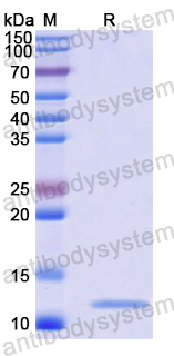 SDS-PAGE for Recombinant Human TRPC4AP Protein, N-His ?>