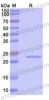 Recombinant Human NSFL1C Protein, N-His-SUMO