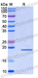 Recombinant Human SETBP1 Protein, N-His-SUMO