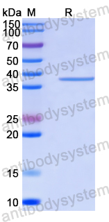 Recombinant Human WDR48 Protein, N-His