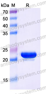 Recombinant Human HSPB8 Protein, C-His