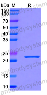 SDS-PAGE for Recombinant Human BIRC7 Protein, N-His-SUMO ?>