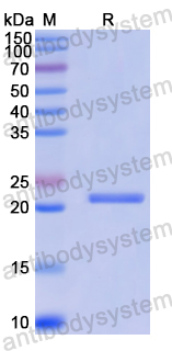 SDS-PAGE for Recombinant Human LRR1 Protein, N-His ?>