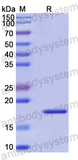 Recombinant Human ZKSCAN3 Protein, N-His