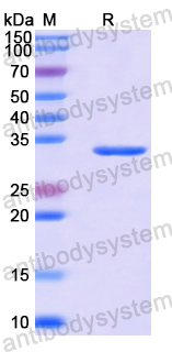 Recombinant Human ZMYND8 Protein, N-His