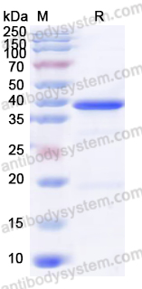 Recombinant Human ZMYND8 Protein, N-His