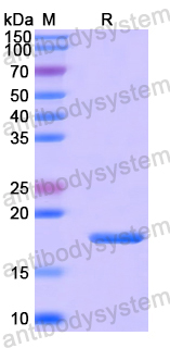 Recombinant Human SCFD1 Protein, N-His