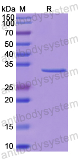 Recombinant Human PPM1K Protein, N-His